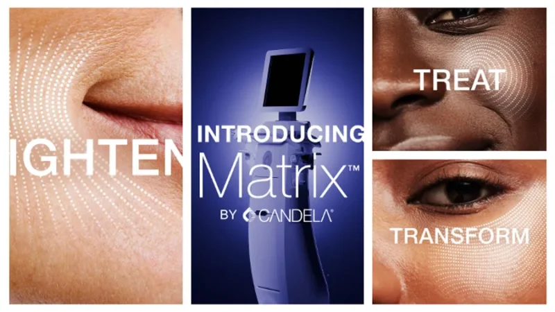 What is RF microneedling, and who is it for?